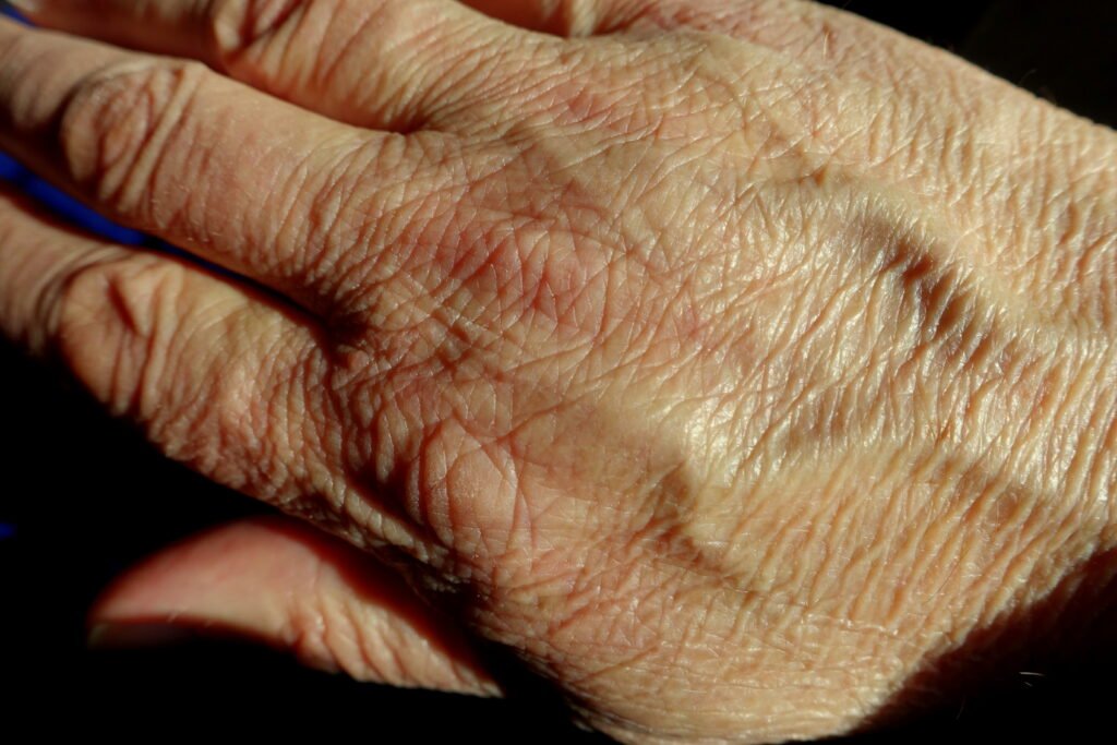 Wrinkled hand - DSC01563